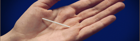 L’implant contraceptif